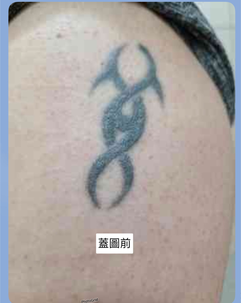刺青蓋圖作品案例前後照分享：前